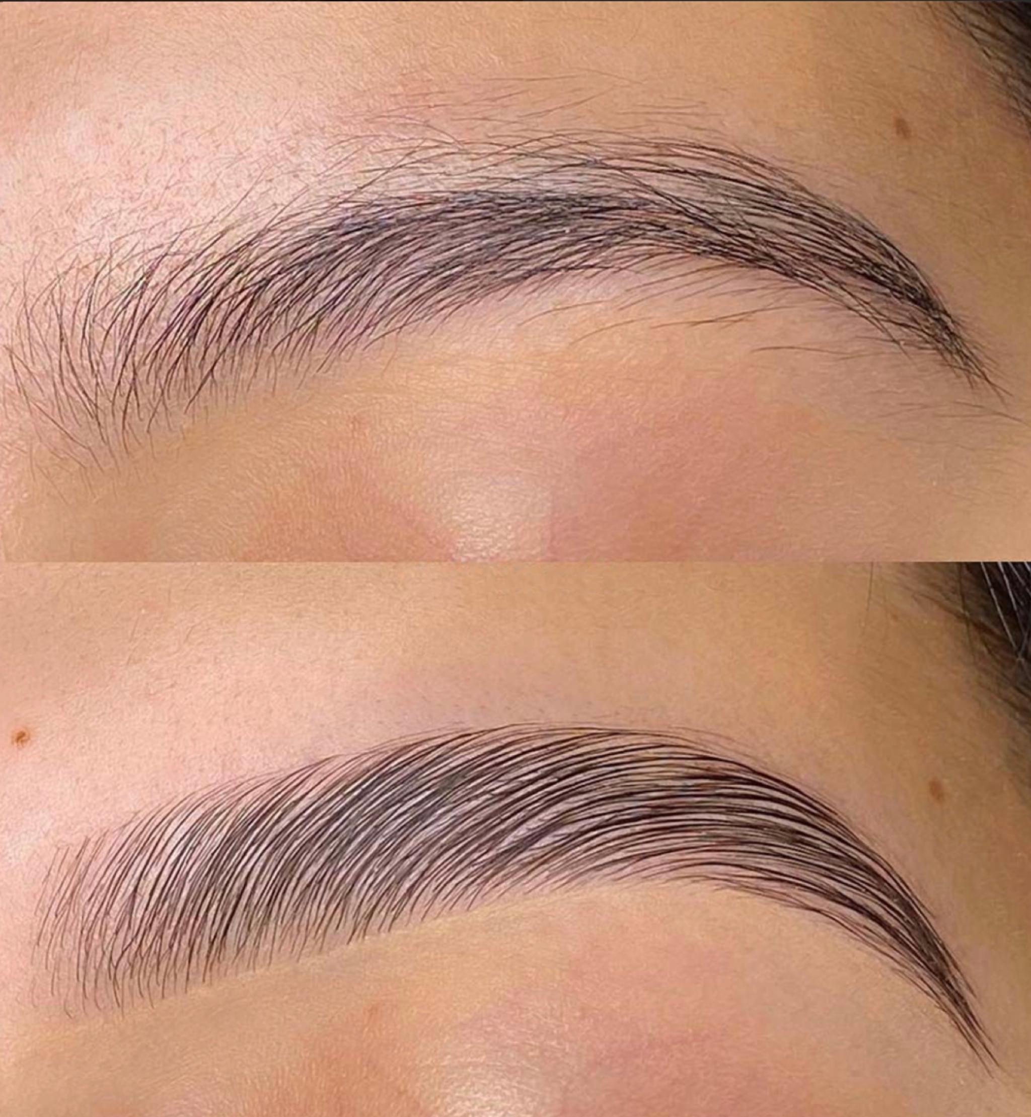 formation browlift